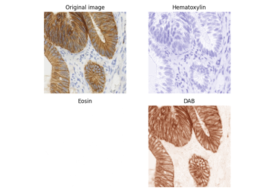 Separate colors in immunohistochemical staining