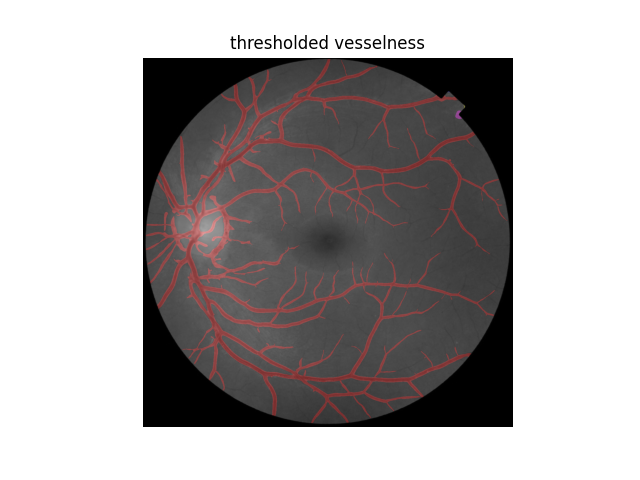 thresholded vesselness