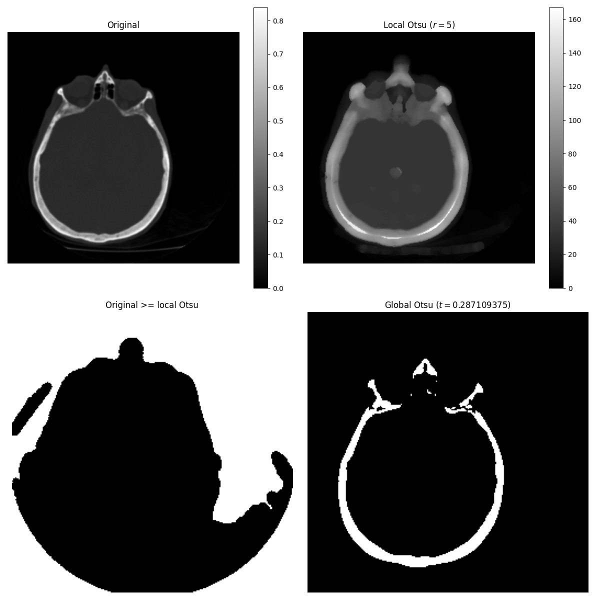 Original, Local Otsu ($r=5$), Original >= local Otsu, Global Otsu ($t=0.287109375$)