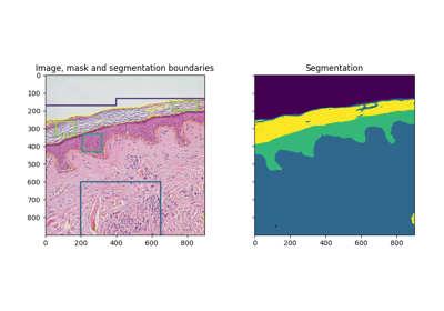 Trainable segmentation using local features and random forests