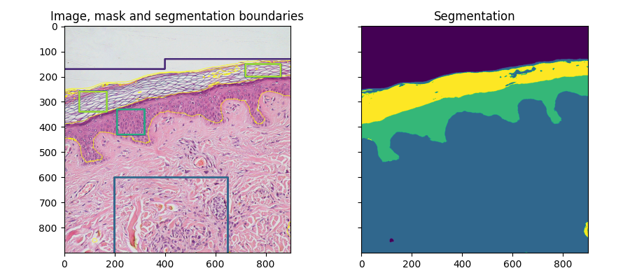 Image, mask and segmentation boundaries, Segmentation