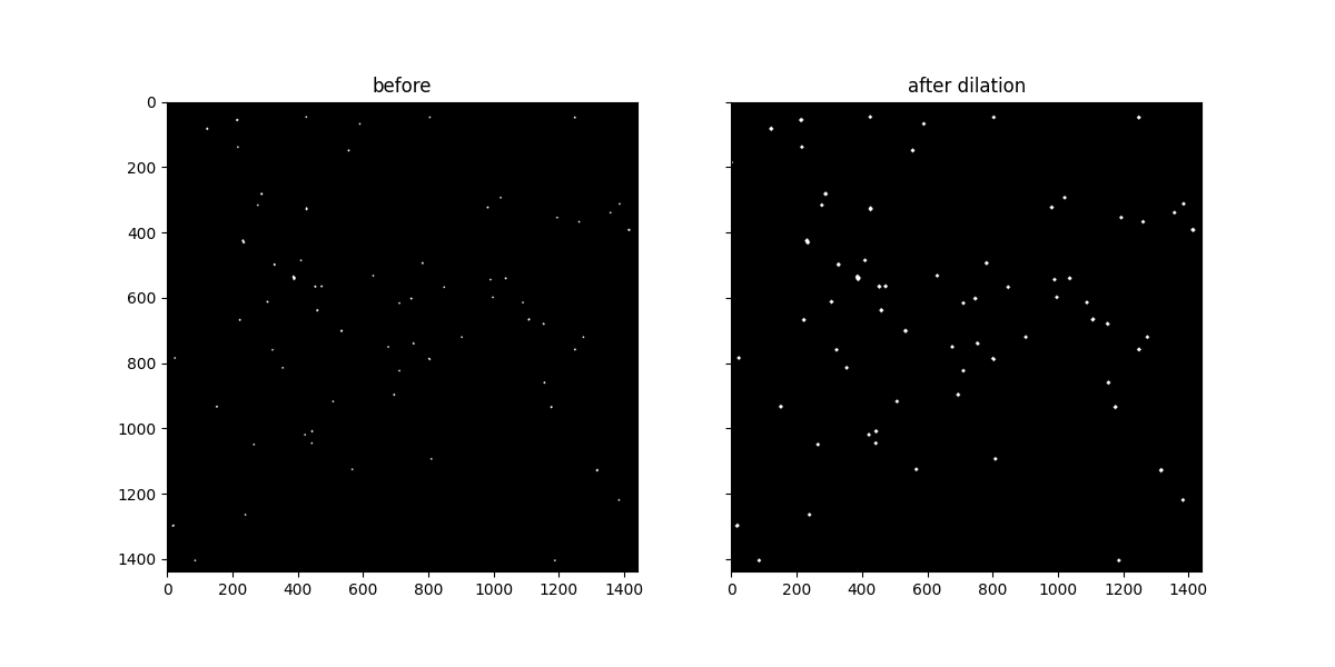 before, after dilation