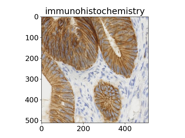 immunohistochemistry