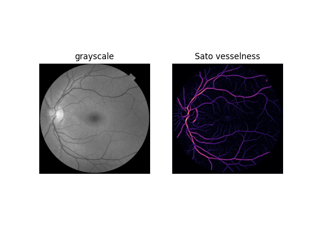 grayscale, Sato vesselness