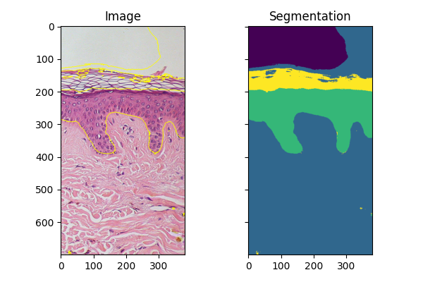 Image, Segmentation