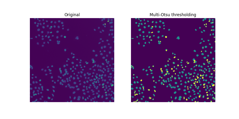 Original, Multi-Otsu thresholding