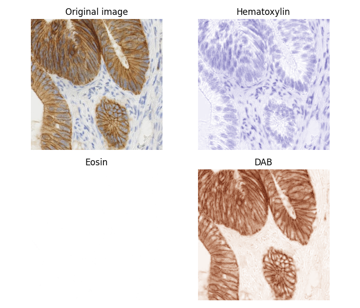 Original image, Hematoxylin, Eosin, DAB