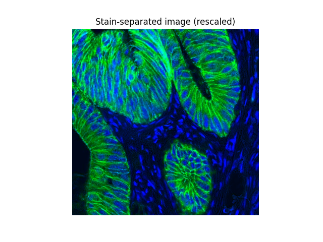 Stain-separated image (rescaled)