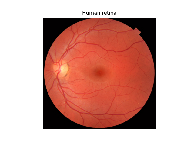 Human retina