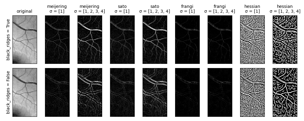 original, meijering σ = [1], meijering σ = [1, 2, 3, 4], sato σ = [1], sato σ = [1, 2, 3, 4], frangi σ = [1], frangi σ = [1, 2, 3, 4], hessian σ = [1], hessian σ = [1, 2, 3, 4]