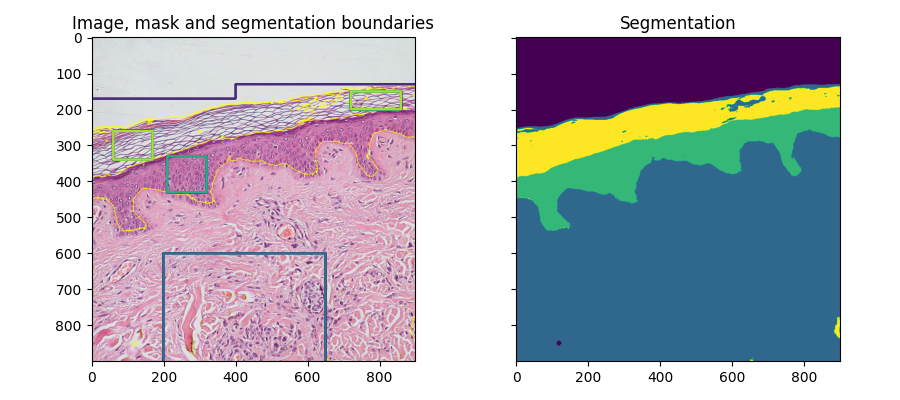 Image, mask and segmentation boundaries, Segmentation