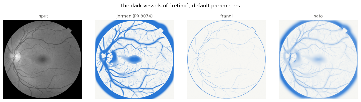 <Figure size 1265x330 with 4 Axes>